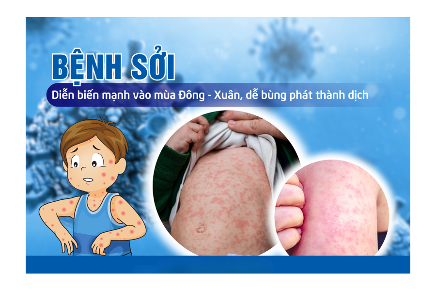 Bệnh sỏi – Những điều cần biết