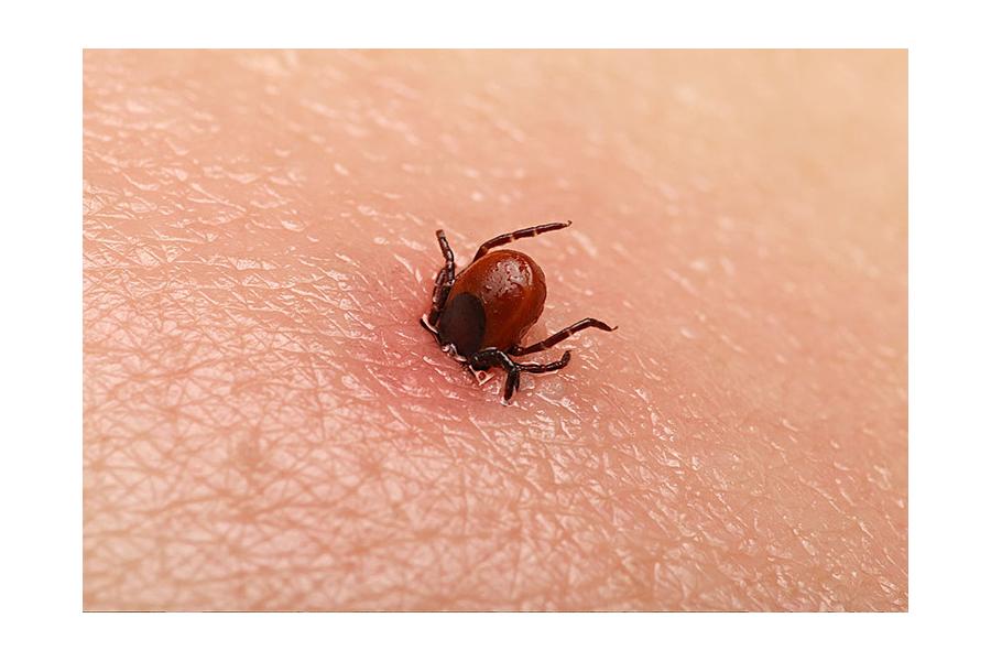 Cẩn trọng sốt mò - Nốt loét ở da không đau, không ngứa